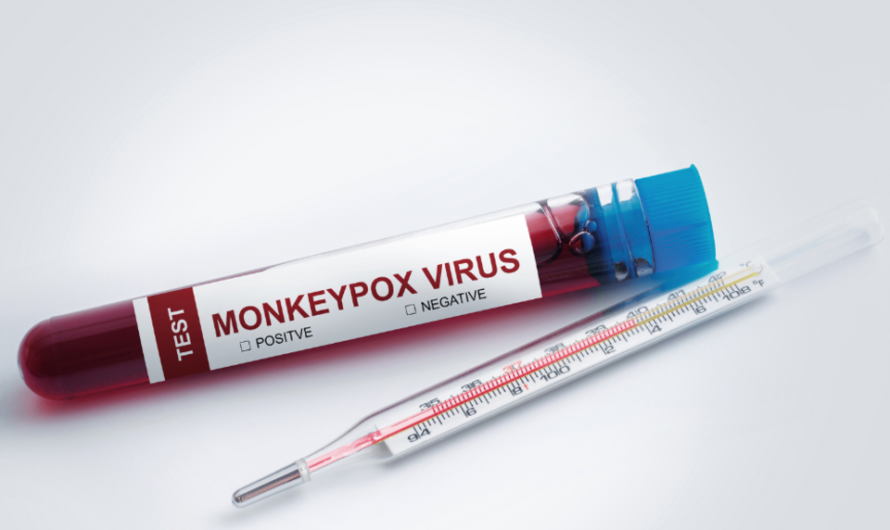 What is Monkeypox Virus? Monkeypox Transmission and Precautions!