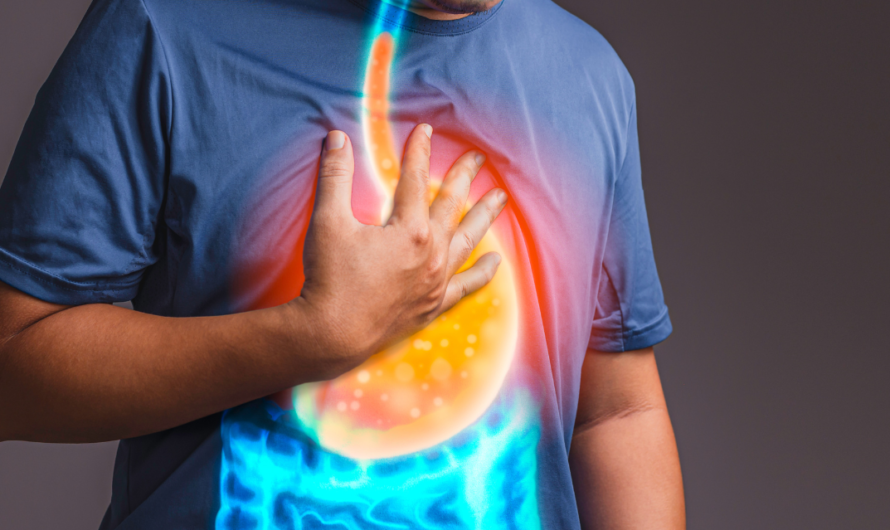 The Effect of Stress and Anxiety on GERD: Effective Coping Strategies