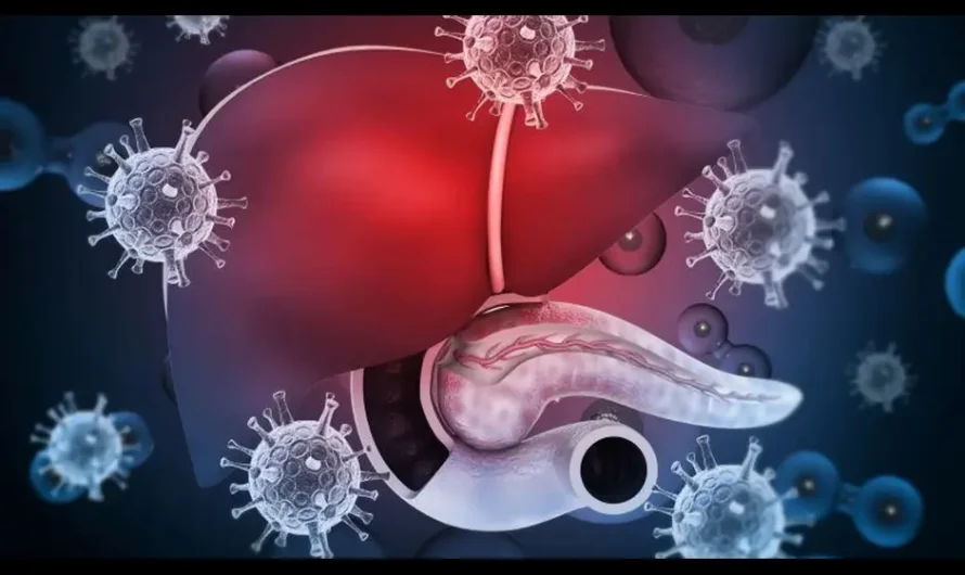 Hepatitis and HIV Co-Infection: Addressing Dual Challenges