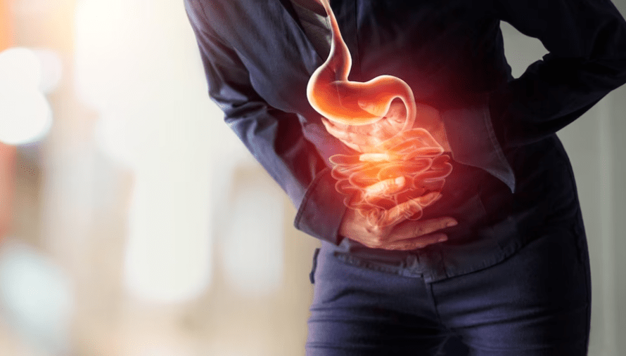 Prevention of Stomach Ulcers, Lifestyle Changes and Tips