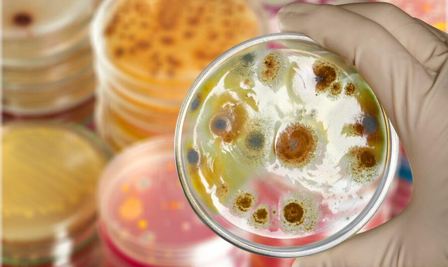 How to get rid of Yeast Infection in 24 Hours