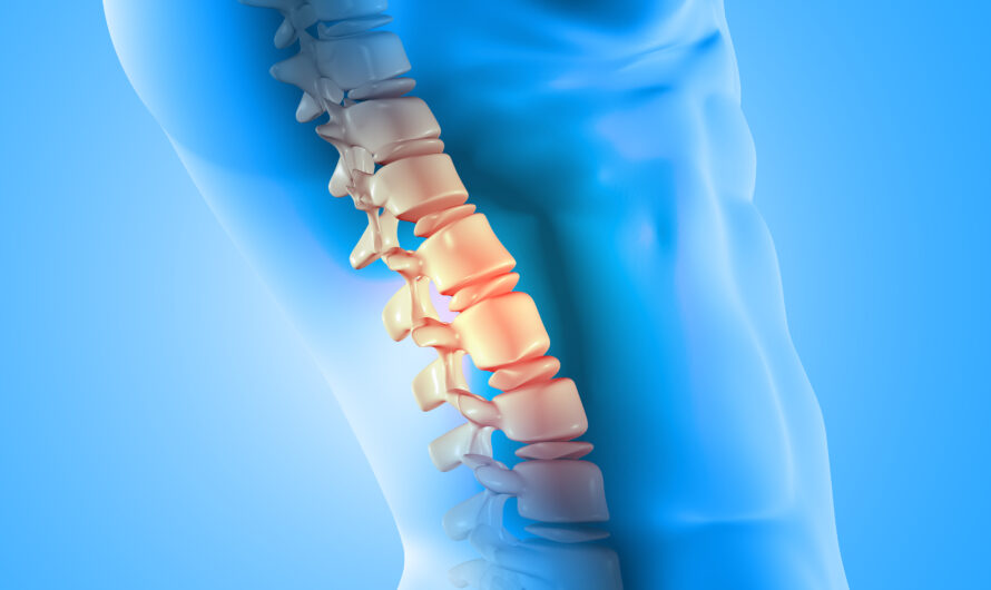 How to Relieve Severe Lower Back Pain