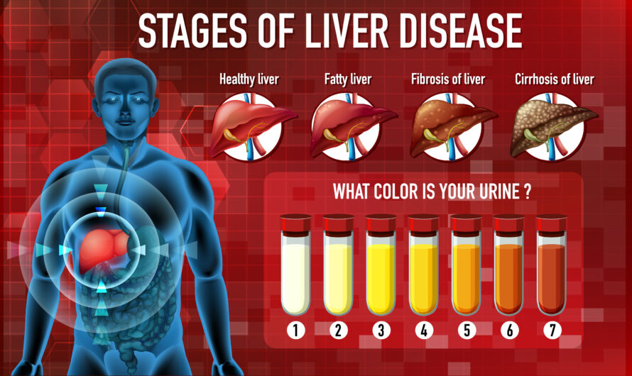 Hepatitis: Types and Symptoms, Is Hepatitis Curable?
